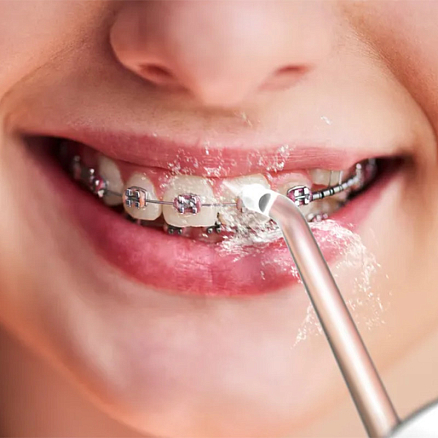 Ирригатор для полости рта Aeno DI1 белый